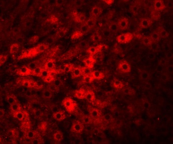 TMEM70 Antibody