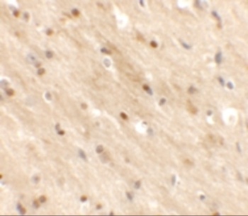TMEM59L Antibody