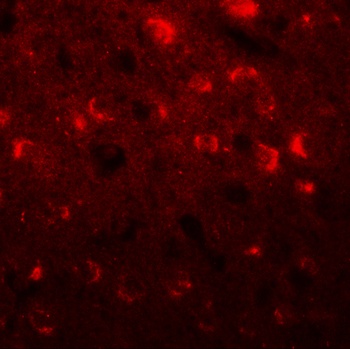 TMEM59L Antibody