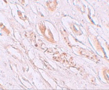 TMEM59 Antibody