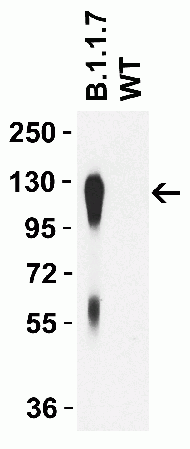 SARS-CoV-2 Spike P681H Antibody [1G8D11] (Alpha, Mu Variant)