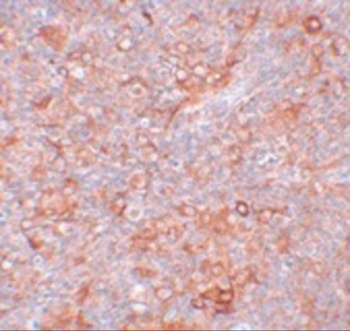 TMEM38B Antibody