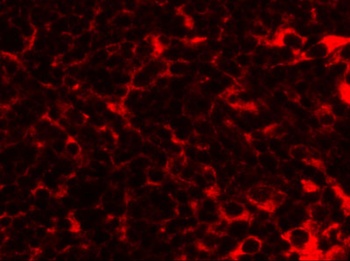 TMEM38B Antibody