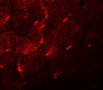 TMEM38A Antibody