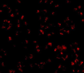 TMEM214 Antibody