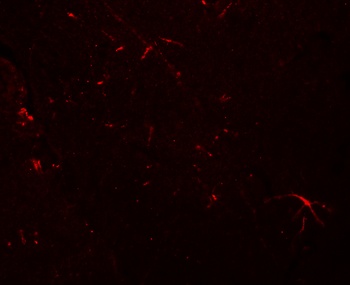 TMEM204 Antibody