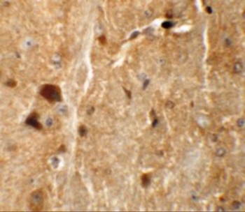 TMEM192 Antibody