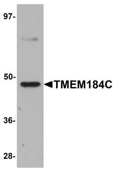 TMEM184C Antibody