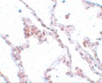 TMEM184B Antibody