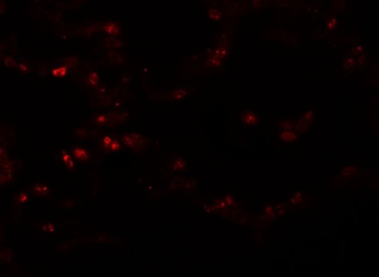 TMEM184B Antibody