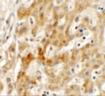 TMEM106B Antibody