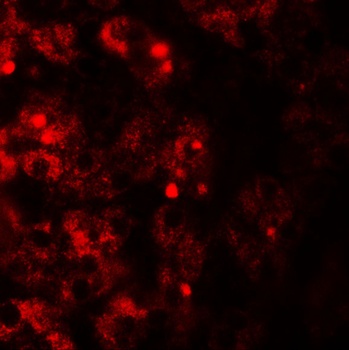 TMEM106B Antibody