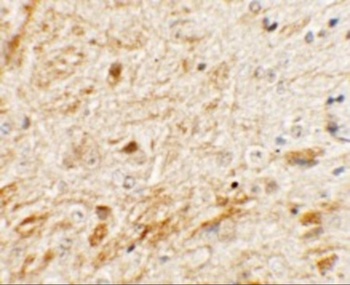 TMEM106A Antibody