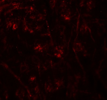 TMEM106A Antibody