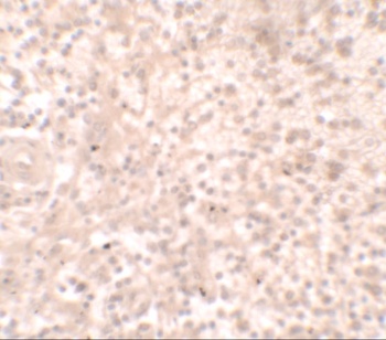 TLX1 Antibody