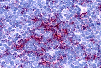 TLR8 Antibody