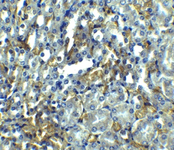 RIPK1 Antibody