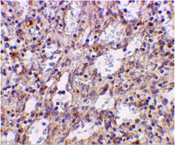 TLR2 Antibody