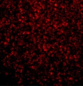 TLR2 Antibody