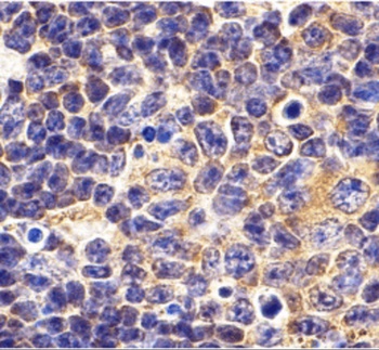 TLR1 Antibody