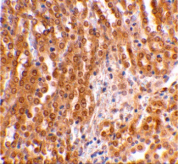 TIRP Antibody