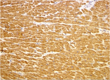 TIRAP Antibody