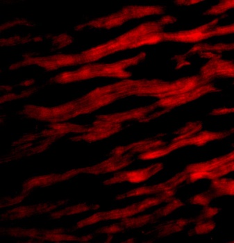 TIRAP Antibody