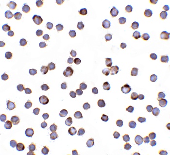 RAIDD Antibody