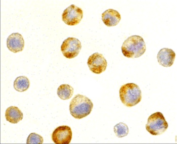 RAIDD Antibody