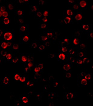 RAIDD Antibody