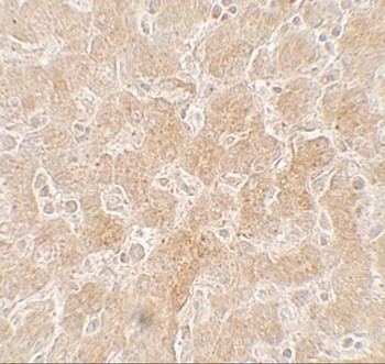 PPARGC1A Antibody