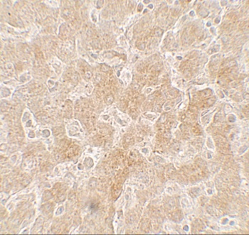 PPARGC1A Antibody