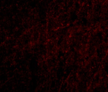 Plxdc2 Antibody
