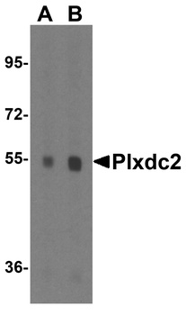 Plxdc2 Antibody