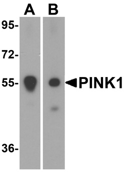 PINK1 Antibody