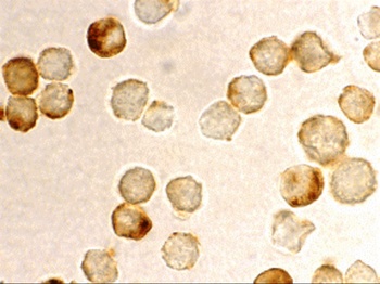 PID Antibody