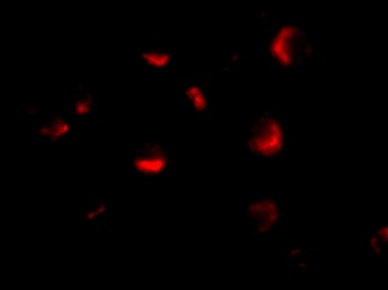 MTA2 Antibody