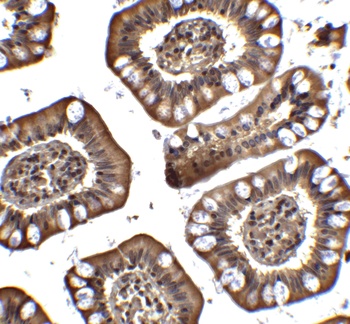 PID Antibody