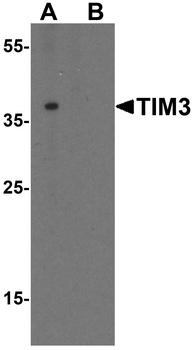 HAVCR2 Antibody