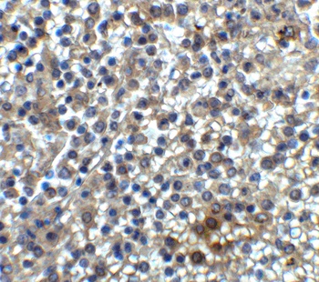 HAVCR2 Antibody