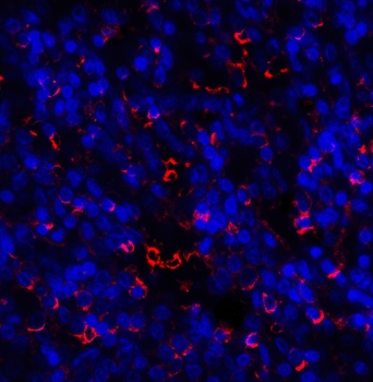 HAVCR2 Antibody