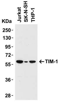 HAVCR1 Antibody