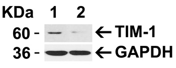 HAVCR1 Antibody