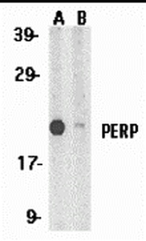 Perp Antibody