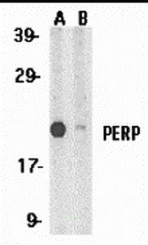 PERP Antibody