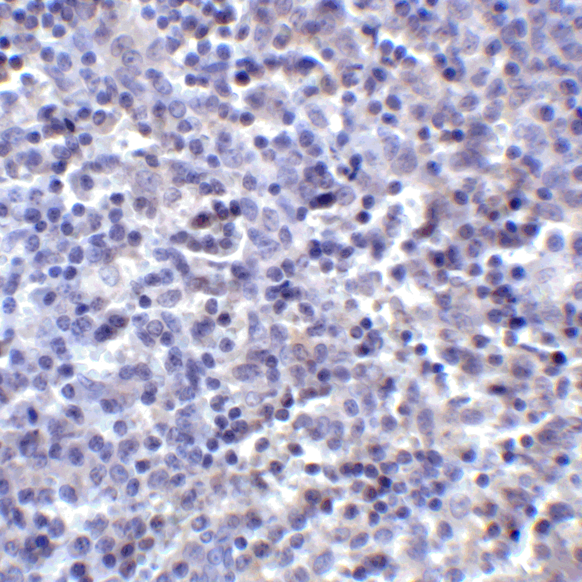 PDL2 Antibody [7C1]