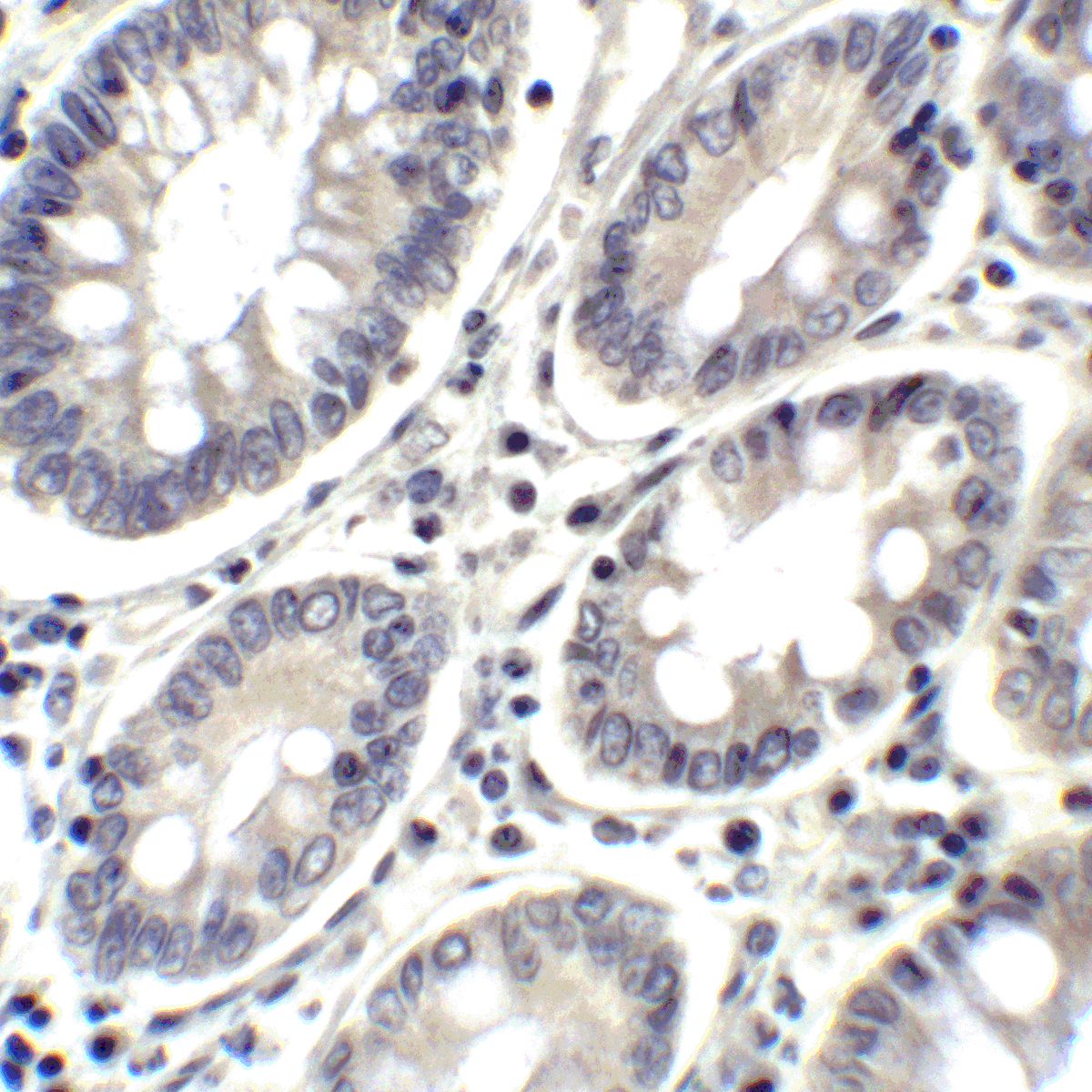 PDL2 Antibody [7C1]