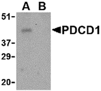 PDCD1 Antibody