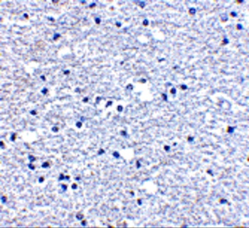 PDCD1 Antibody