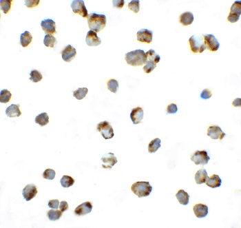 PDCD1 Antibody